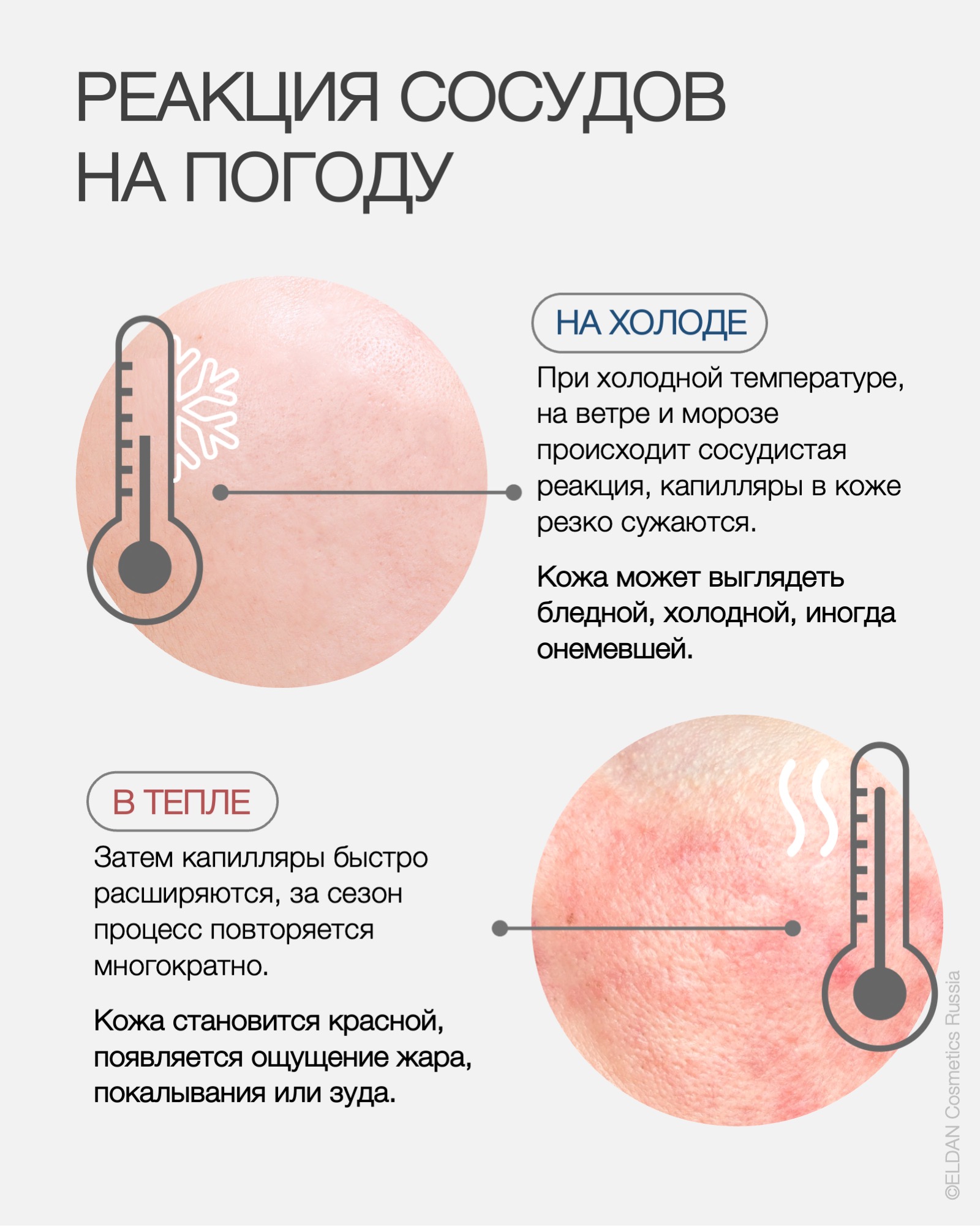 Пост краснота зимой 2 .jpg